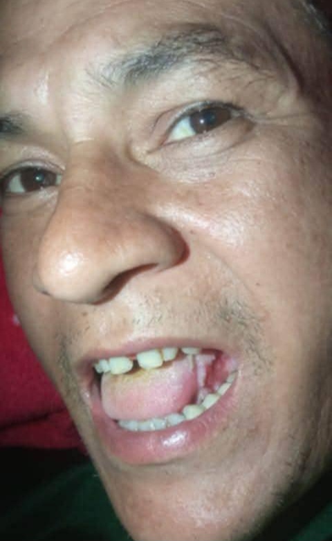 आलितालका क्यान्सर पीडित दिनेश बोहराको उपचारका लागि सहयोगको अपिल