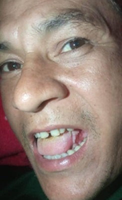 आलितालका क्यान्सर पीडित दिनेश बोहराको उपचारका लागि सहयोगको अपिल