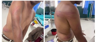 डडेल्धुराका एकजना वडाध्यक्षमाथि हातपात